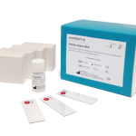 Lames de vitalité SCA